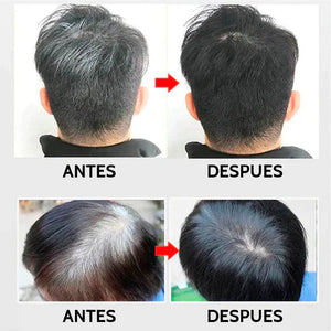 Shampoo Cubre Canas